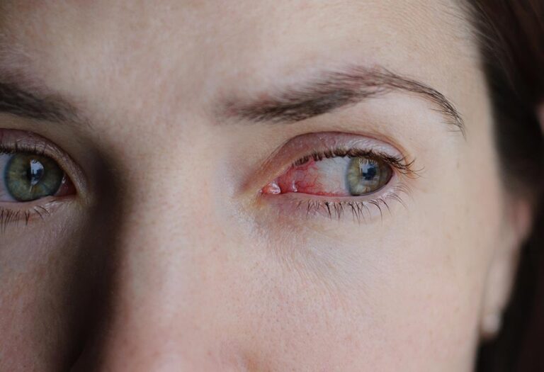 Një terapeutik i ri në formë të pikave të syve mund të jetë premtues në trajtimin e syve të dëmtuar nga diabeti